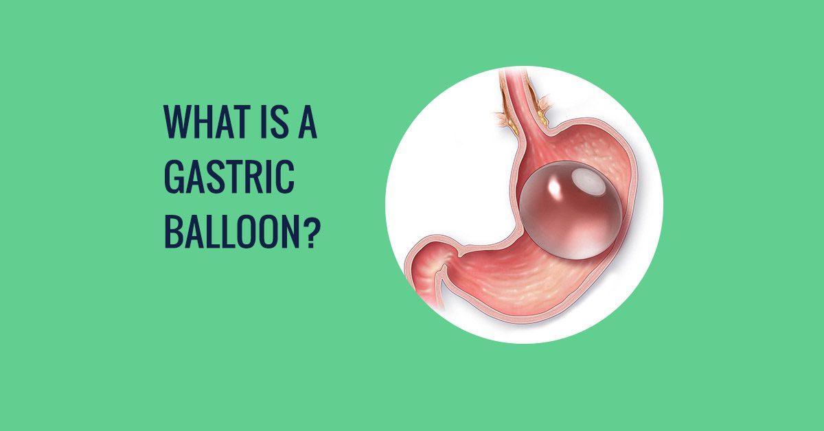 What is a gastric balloon healthyweightaustralia
