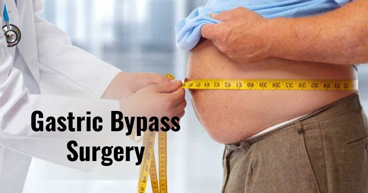 Gastric Bypass Surgery healthyweightaustralia
